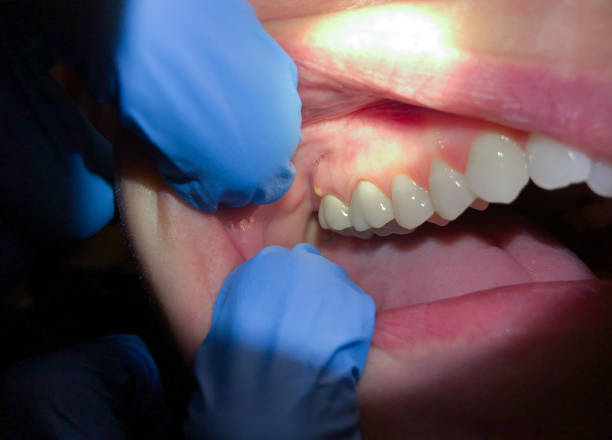 Best Emergency Orthodontic Repairs in Macom, IL