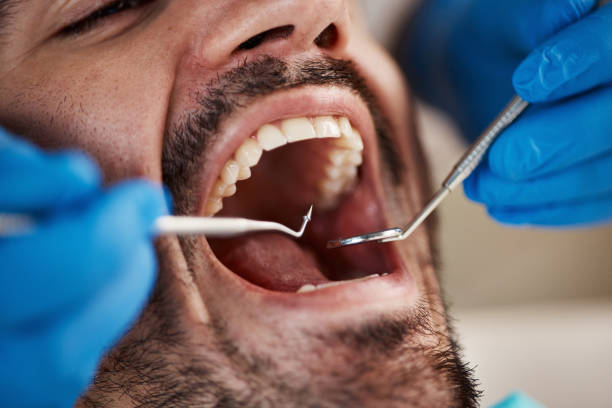Best 24-Hour Emergency Dental Care in Macom, IL